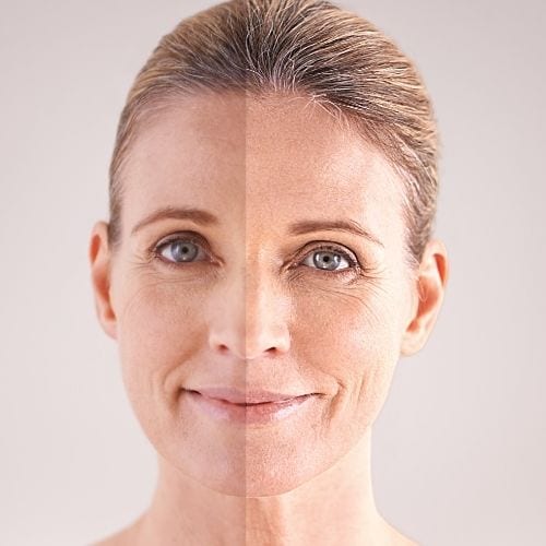 היפר פיגמנטציה בעור – כל מה שצריך לדעת