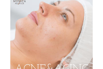 Acne & Aging – עור עם אקנה וסימני גיל